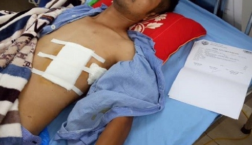 Bắc Giang: Nam thanh niên suýt mất mạng vì bị tấn công bằng súng, dao bầu?