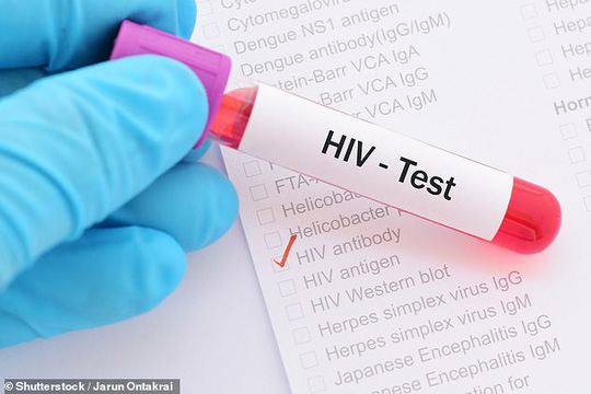Phat-hien-co-che-giup-chua-khoi-HIV-ngay-trong-nao-nguoi-hiv-test-1544413857-975-width540height360