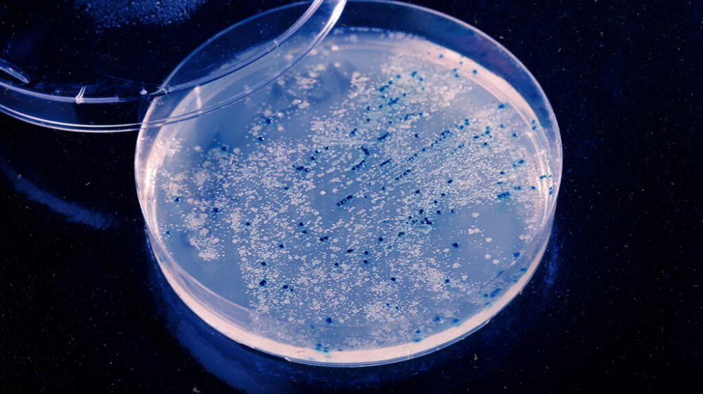 bacteria-mcirobiology-petri-dish-header-1024x575