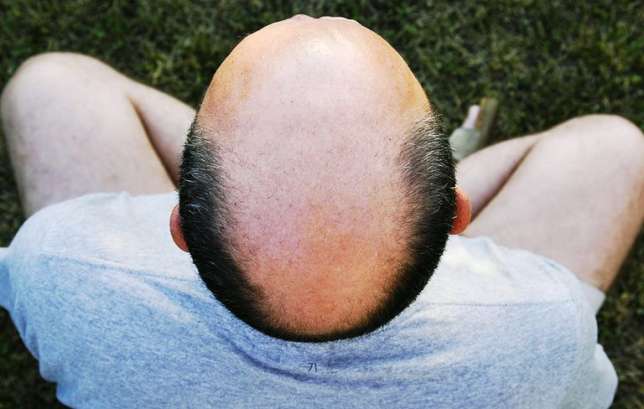 how-shave-bald-head-1516196127