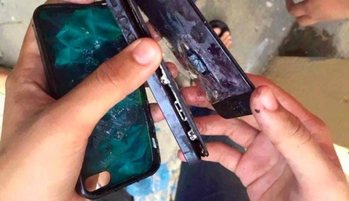 Những vụ iPhone phát nổ để lại hậu quả nghiêm trọng (P1)