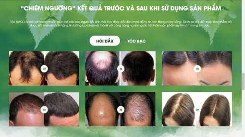 Sản phẩm Tóc Haco: Quảng cáo quá đà, người trong cuộc nói gì?