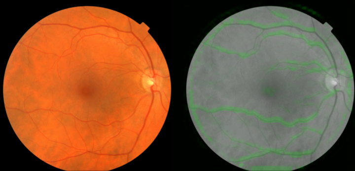 4248011_fundus_images