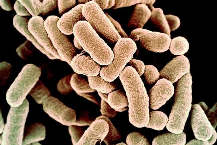 vi khuan e coli