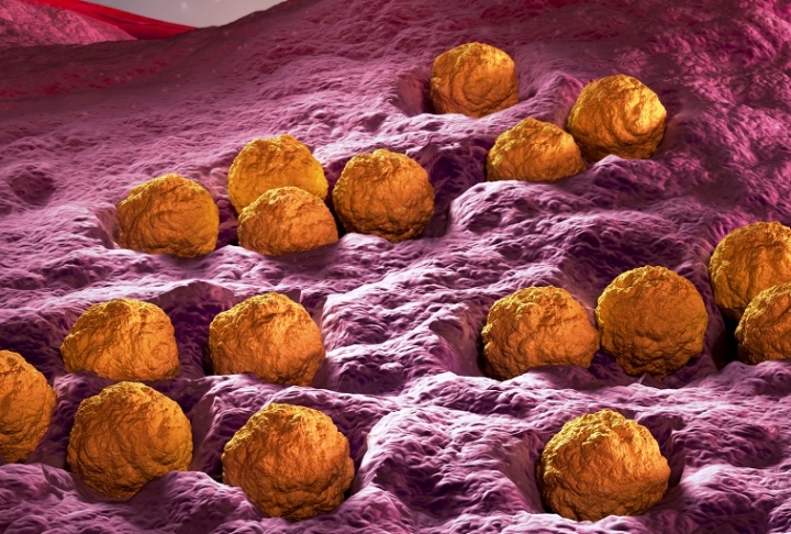 Rubella-2