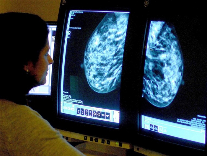 breast-cancer-nbc-15936255833451202816493